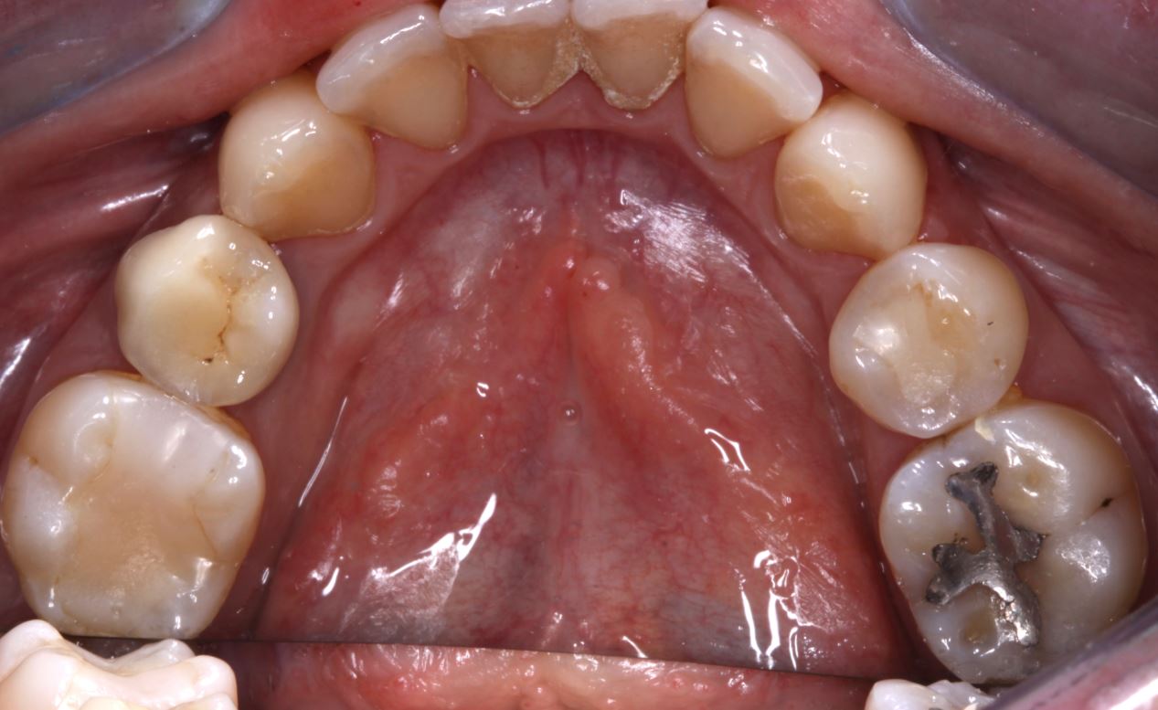 Prima_Igiene_Dentale