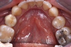Prima_Igiene_Dentale
